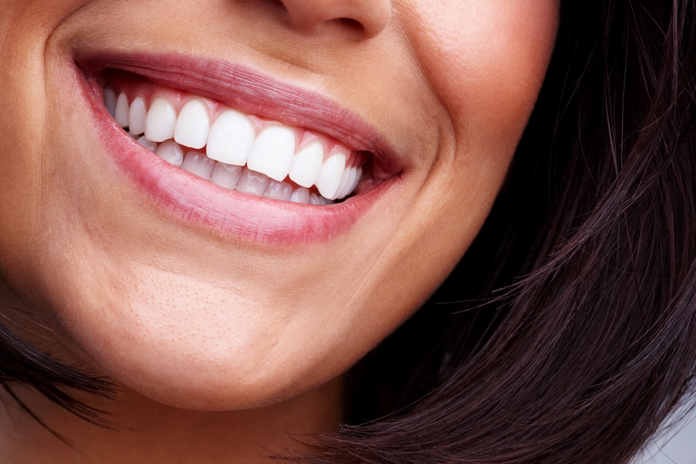 A close-up of a woman's smile with beautiful white teeth. 